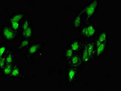 Immunofluorescent analysis of Hela cells using MYF6 Antibody at dilution of 1:100 and Alexa Fluor 488-congugated AffiniPure Goat Anti-Rabbit IgG(H+L)Rabbit anti-Human MYF6 Polyclonal Antibody
