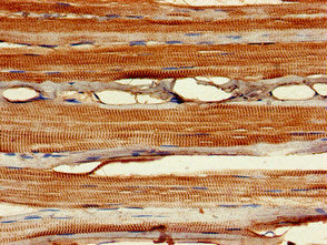 Immunohistochemistry of paraffin-embedded human skeletal muscle tissue using MYF6 Antibody at dilution of 1:100Rabbit anti-Human MYF6 Polyclonal Antibody
