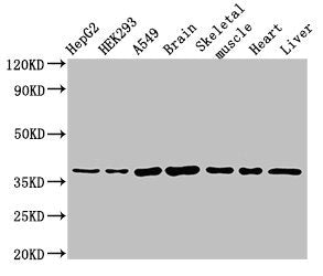 Western Blot  | Positive WB detected in: HepG2 whole cell lysate, HEK293 whole cell lysate, A549 whole cell lysate, Mouse brain tissue, Mouse skeletal muscle tissue, Rat heart tissue, Rat liver tissue  | All lanes: MYF6 antibody at 3µg/ml  | Secondary  | Goat polyclonal to rabbit IgG at 1/50000 dilution  | Predicted band size: 27 kDa  | Observed band size: 37 kDaRabbit anti-Human MYF6 Polyclonal Antibody
