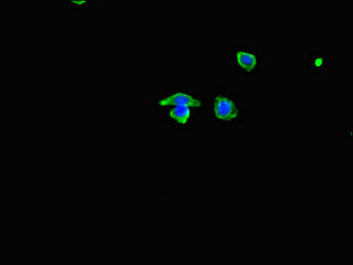 Immunofluorescent analysis of HepG2 cells using MYH3 Antibody at dilution of 1:100 and Alexa Fluor 488-congugated AffiniPure Goat Anti-Rabbit IgG(H+L)Rabbit anti-Human MYH3 Polyclonal Antibody