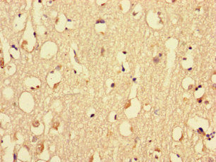 Immunohistochemistry of paraffin-embedded human brain tissue using the antibody at dilution of 1:100Rabbit anti-Human MYH3 Polyclonal Antibody