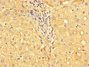 Immunohistochemistry of paraffin-embedded human liver tissue using MYH3 Antibody at dilution of 1:100Rabbit anti-Human MYH3 Polyclonal Antibody