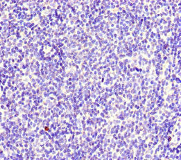 Immunohistochemistry of paraffin-embedded human lymph node tissue using the antibody at dilution of 1:100Rabbit anti-Human MYO1G Polyclonal Antibody