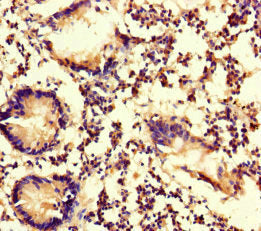 Immunohistochemistry of paraffin-embedded human appendix tissue using MYO1G Antibody at dilution of 1:100Rabbit anti-Human MYO1G Polyclonal Antibody