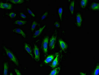 Immunofluorescent analysis of Hela cells using SNRPG Antibody at dilution of 1:100 and Alexa Fluor 488-congugated AffiniPure Goat Anti-Rabbit IgG(H+L)Rabbit anti-Human SNRPG Polyclonal Antibody