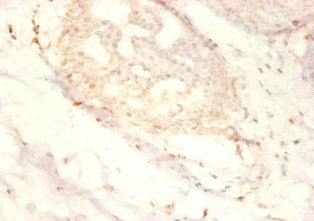 Immunohistochemistry of paraffin-embedded human mammary gland tissue using SNRPG Antibody at dilution of 1:50Rabbit anti-Human SNRPG Polyclonal Antibody