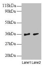 Western blot  | All lanes: SNRPG antibody at 2µg/ml  | Lane 1: EC109 whole cell lysate  | Lane 2: 293T whole cell lysate  | Secondary  | Goat polyclonal to rabbit IgG at 1/15000 dilution  | Predicted band size: 9 kDa  | Observed band size: 36 kDaRabbit anti-Human SNRPG Polyclonal Antibody