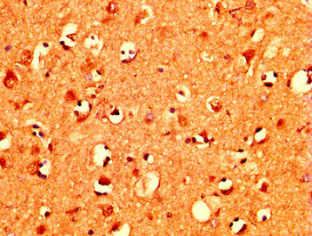 IHC image of MZF1 Antibody diluted at 1:400 and staining in paraffin-embedded human brain tissue performed on a Leica BondTM system. After dewaxing and hydration, antigen retrieval was mediated by high pressure in a citrate buffer (pH 6.0). Section was blocked with 10% normal goat serum 30min at RT. Then primary antibody (1% BSA) was incubated at 4°C overnight. The primary is detected by a biotinylated secondary antibody and visualized using an HRP conjugated SP system.Rabbit anti-Human MZF1 Polyclonal Antibody
