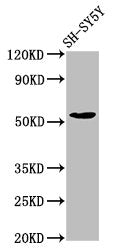 Western Blot  | Positive WB detected in: SH-SY5Y whole cell lysate  | All lanes: MZF1 antibody at 7.7µg/ml  | Secondary  | Goat polyclonal to rabbit IgG at 1/50000 dilution  | Predicted band size: 83, 55, 32 kDa  | Observed band size: 55 kDaRabbit anti-Human MZF1 Polyclonal Antibody