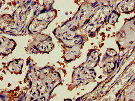 Immunohistochemistry of paraffin-embedded human placenta tissue using NAMPT Antibody at dilution of 1:100Rabbit anti-Human NAMPT Polyclonal Antibody