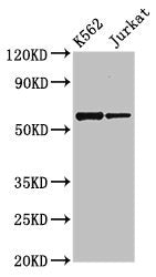 Western Blot  | Positive WB detected in: K562 whole cell lysate, Jurkat whole cell lysate  | All lanes: NAMPT antibody at 2.7µg/ml  | Secondary  | Goat polyclonal to rabbit IgG at 1/50000 dilution  | Predicted band size: 56 kDa  | Observed band size: 56 kDaRabbit anti-Human NAMPT Polyclonal Antibody