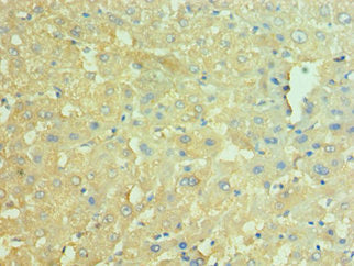 Immunohistochemistry of paraffin-embedded human liver tissue using the antibody at dilution of 1:100Rabbit anti-Human NAMPT Polyclonal Antibody