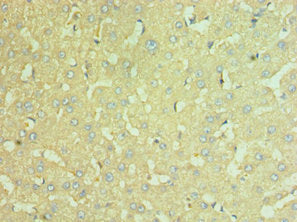 Immunohistochemistry of paraffin-embedded human liver tissue using NAMPT Antibody at dilution of 1:100Rabbit anti-Human NAMPT Polyclonal Antibody