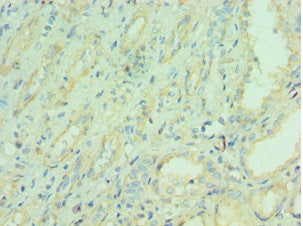 Immunohistochemistry of paraffin-embedded human kidney tissue using NAMPT Antibody at dilution of 1:100Rabbit anti-Human NAMPT Polyclonal Antibody