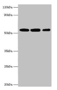 Western blot | All lanes: Nicotinamide phosphoribosyltransferase antibody at 4μg/ml | Lane 1: Mouse heart tissue | Lane 2: Mouse liver tissue | Lane 3: Mouse skeletal muscle tissue | Secondary | Goat polyclonal to rabbit IgG at 1/10000 dilution | Predicted band size: 56 kDa | Observed band size: 56 kDaRabbit anti-Human NAMPT Polyclonal Antibody