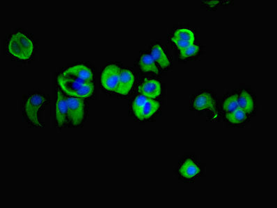 Immunofluorescent analysis of MCF-7 cells using NAPA Antibody at dilution of 1:100 and Alexa Fluor 488-congugated AffiniPure Goat Anti-Rabbit IgG(H+L)Rabbit anti-Human NAPA Polyclonal Antibody