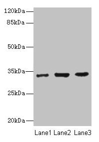 Western blot  | All lanes: NAPA antibody at 7µg/ml  | Lane 1: 293T whole cell lysate  | Lane 2: Hela whole cell lysate  | Lane 3: K562 whole cell lysate  | Secondary  | Goat polyclonal to rabbit IgG at 1/10000 dilution  | Predicted band size: 34 kDa  | Observed band size: 34 kDaRabbit anti-Human NAPA Polyclonal Antibody