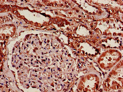 IHC image of YWHAB Antibody diluted at 1:600 and staining in paraffin-embedded human kidney tissue performed on a Leica BondTM system. After dewaxing and hydration, antigen retrieval was mediated by high pressure in a citrate buffer (pH 6.0). Section was blocked with 10% normal goat serum 30min at RT. Then primary antibody (1% BSA) was incubated at 4°C overnight. The primary is detected by a biotinylated secondary antibody and visualized using an HRP conjugated SP system.Rabbit anti-Human YWHAB Polyclonal Antibody