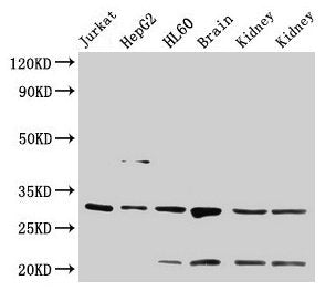 Western Blot  | Positive WB detected in: Jurkat whole cell lysate, HepG2 whole cell lysate, HL60 whole cell lysate, Rat brain tissue, Rat kidney tissue, Mouse kidney tissue  | All lanes: YWHAB antibody at 4µg/ml  | Secondary  | Goat polyclonal to rabbit IgG at 1/50000 dilution  | Predicted band size: 29, 28 kDa  | Observed band size: 29 kDaRabbit anti-Human YWHAB Polyclonal Antibody