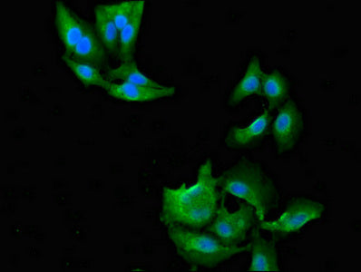 Immunofluorescent analysis of Hela cells using NAT1 Antibody at dilution of 1:100 and Alexa Fluor 488-congugated AffiniPure Goat Anti-Rabbit IgG(H+L)Rabbit anti-Human NAT1 Polyclonal Antibody