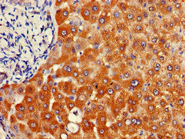 Immunohistochemistry of paraffin-embedded human liver tissue using NAT1 Antibody at dilution of 1:100Rabbit anti-Human NAT1 Polyclonal Antibody