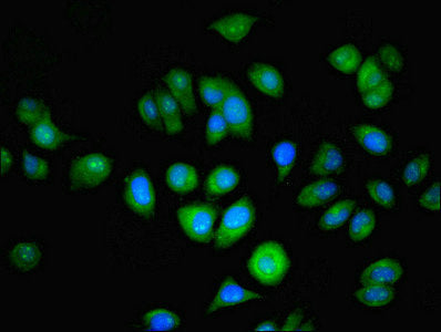 Immunofluorescent analysis of A549 cells using NAT2 Antibody at dilution of 1:100 and Alexa Fluor 488-congugated AffiniPure Goat Anti-Rabbit IgG(H+L)Rabbit anti-Human NAT2 Polyclonal Antibody