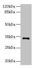 Western blot  | All lanes: NAT2 antibody at 6µg/ml + Mouse brain tissue  | Secondary  | Goat polyclonal to rabbit IgG at 1/10000 dilution  | Predicted band size: 34 kDa  | Observed band size: 34 kDaRabbit anti-Human NAT2 Polyclonal Antibody