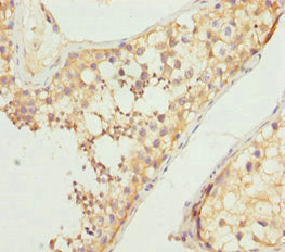 Immunohistochemistry of paraffin-embedded human testis tissue using NCALD Antibody at dilution of 1:100Rabbit anti-Human NCALD Polyclonal Antibody