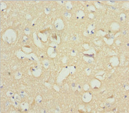 Immunohistochemistry of paraffin-embedded human brain tissue using NCALD Antibody at dilution of 1:100Rabbit anti-Human NCALD Polyclonal Antibody