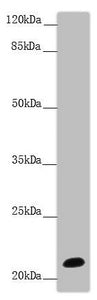 Western blot | All lanes: NCALD antibody at 9.32 μg/ml + Mouse brain tissue | Secondary | Goat polyclonal to rabbit IgG at 1/10000 dilution | Predicted band size: 22 kDa | Observed band size: 22 kDaRabbit anti-Human NCALD Polyclonal Antibody