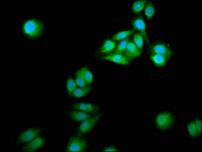 Immunofluorescence staining of HepG2 cells with NCDN Antibody at 1:166, counter-stained with DAPI. The cells were fixed in 4% formaldehyde, permeabilized using 0.2% Triton X-100 and blocked in 10% normal Goat Serum. The cells were then incubated with the antibody overnight at 4°C. The secondary antibody was Alexa Fluor 488-congugated AffiniPure Goat Anti-Rabbit IgG(H+L).Rabbit anti-Human NCDN Polyclonal Antibody