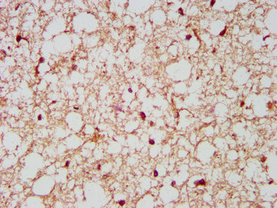 IHC image of NCDN Antibody diluted at 1:500 and staining in paraffin-embedded human brain tissue performed on a Leica BondTM system. After dewaxing and hydration, antigen retrieval was mediated by high pressure in a citrate buffer (pH 6.0). Section was blocked with 10% normal goat serum 30min at RT. Then primary antibody (1% BSA) was incubated at 4°C overnight. The primary is detected by a biotinylated secondary antibody and visualized using an HRP conjugated SP system.Rabbit anti-Human NCDN Polyclonal Antibody
