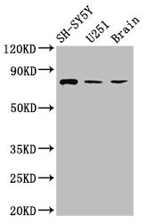 Western Blot  | Positive WB detected in: SH-SY5Y whole cell lysate, U251 whole cell lysate, Rat brain tissue  | All lanes: NCDN antibody at 2.6µg/ml  | Secondary  | Goat polyclonal to rabbit IgG at 1/50000 dilution  | Predicted band size: 79, 78, 80 kDa  | Observed band size: 79 kDaRabbit anti-Human NCDN Polyclonal Antibody