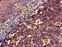 Immunohistochemistry of paraffin-embedded human tonsil tissue using NCF1 Antibody at dilution of 1:100Rabbit anti-Human NCF1 Polyclonal Antibody
