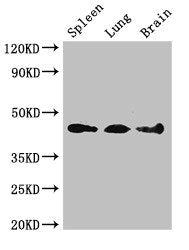 Western Blot | Positive WB detected in: Mouse spleen tissue, Mouse lung tissue, Mouse brain tissue | All lanes: NCF1 antibody at 3μg/ml | Secondary | Goat polyclonal to rabbit IgG at 1/50000 dilution | Predicted band size: 45, 31 kDa | Observed band size: 45 kDaRabbit anti-Human NCF1 Polyclonal Antibody