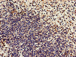 Immunohistochemistry analysis of human spleen tissue using NCF2 Antibody at dilution of 1:100Rabbit anti-Human NCF2 Polyclonal Antibody