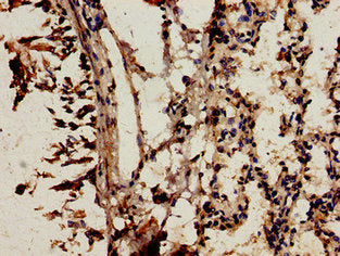 Immunocytochemistry analysis of human lung tissue using NCF2 Antibody at dilution of 1:100Rabbit anti-Human NCF2 Polyclonal Antibody