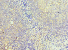 Immunohistochemistry of paraffin-embedded human tonsil tissue using NCK1 Antibody at dilution of 1:100Rabbit anti-Human NCK1 Polyclonal Antibody