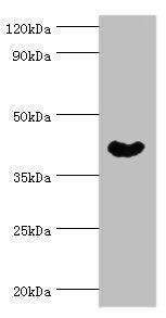 Western blot | All lanes: Cytoplasmic protein NCK1 antibody at 4μg/ml + Rat liver tissue | Secondary | Goat polyclonal to rabbit IgG at 1/10000 dilution | Predicted band size: 43, 36 kDa | Observed band size: 43 kDaRabbit anti-Human NCK1 Polyclonal Antibody