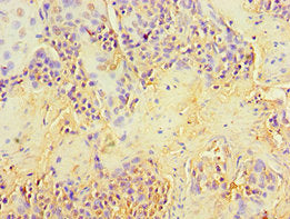 Immunohistochemistry of paraffin-embedded human tonsil tissue using NCK2 Antibody at dilution of 1:100Rabbit anti-Human NCK2 Polyclonal Antibody