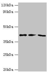 Western blot | All lanes: NCK2 antibody at 10μg/ml | Lane 1: Mouse spleen tissue | Lane 2: Mouse brain tissue | Lane 3: Mouse kidney tissue | Secondary | Goat polyclonal to rabbit IgG at 1/10000 dilution | Predicted band size: 43 kDa | Observed band size: 43 kDaRabbit anti-Human NCK2 Polyclonal Antibody