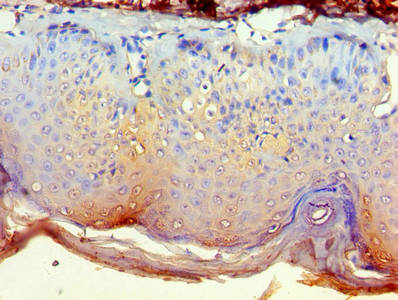 Immunohistochemistry of paraffin-embedded human skin tissue using NCK2 Antibody at dilution of 1:100Rabbit anti-Human NCK2 Polyclonal Antibody