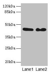 Western blot  | All lanes: NCK2 antibody at 8µg/ml  | Lane 1: Mouse brain tissue  | Lane 2: Mouse kidney tissue  | Secondary  | Goat polyclonal to rabbit IgG at 1/10000 dilution  | Predicted band size: 43 kDa  | Observed band size: 43 kDaRabbit anti-Human NCK2 Polyclonal Antibody