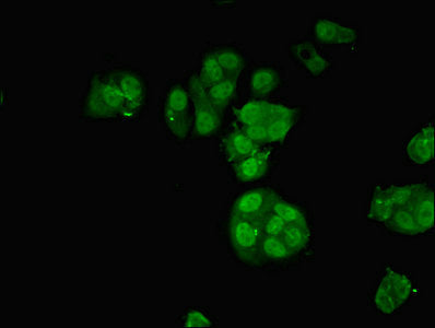 Immunofluorescent analysis of MCF-7 cells using NCOA4 Antibody at dilution of 1:100 and Alexa Fluor 488-congugated AffiniPure Goat Anti-Rabbit IgG(H+L)Rabbit anti-Human NCOA4 Polyclonal Antibody