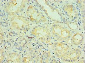 Immunohistochemistry of paraffin-embedded human kidney tissue using the antibody at dilution of 1:100Rabbit anti-Human NCOA4 Polyclonal Antibody