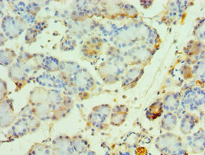 Immunohistochemistry of paraffin-embedded human pancreatic tissue using NCOA4 Antibody at dilution of 1:100Rabbit anti-Human NCOA4 Polyclonal Antibody