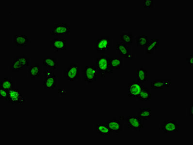 Immunofluorescent analysis of Hela cells using RPA2 Antibody at dilution of 1:100 and Alexa Fluor 488-congugated AffiniPure Goat Anti-Rabbit IgG(H+L)Rabbit anti-Human RPA2 Polyclonal Antibody