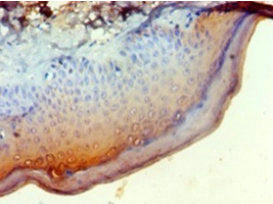 Immunohistochemistry of paraffin-embedded human skin tissue using NDST1 Antibody at dilution of 1:100Rabbit anti-Human NDST1 Polyclonal Antibody