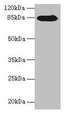 Western blot  | All lanes: NDST1 antibody at 6µg/ml + MCF-7 whole cell lysate  | Secondary  | Goat polyclonal to rabbit IgG at 1/10000 dilution  | Predicted band size: 101, 63 kDa  | Observed band size: 85 kDaRabbit anti-Human NDST1 Polyclonal Antibody