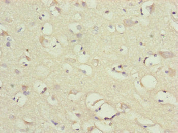 Immunohistochemistry of paraffin-embedded human brain tissue using NDUFB10 Antibody at dilution of 1:100Rabbit anti-Human NDUFB10 Polyclonal Antibody
